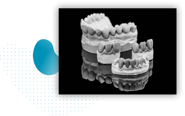previaimplantcenter-dental-prosthesis-the-appropriate-types-of-prosthesis